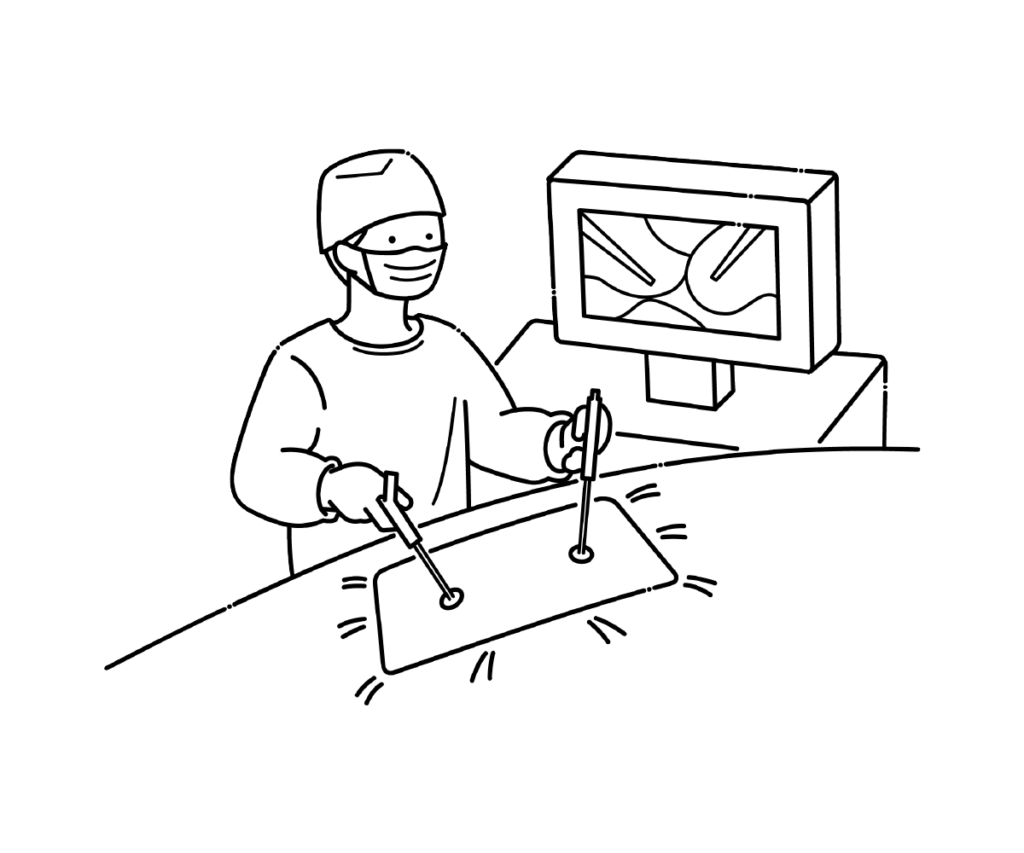 腹腔鏡手術（投影）の白黒イラスト
