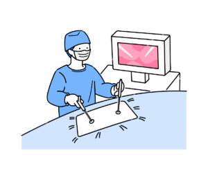 腹腔鏡手術（投影）のイラスト