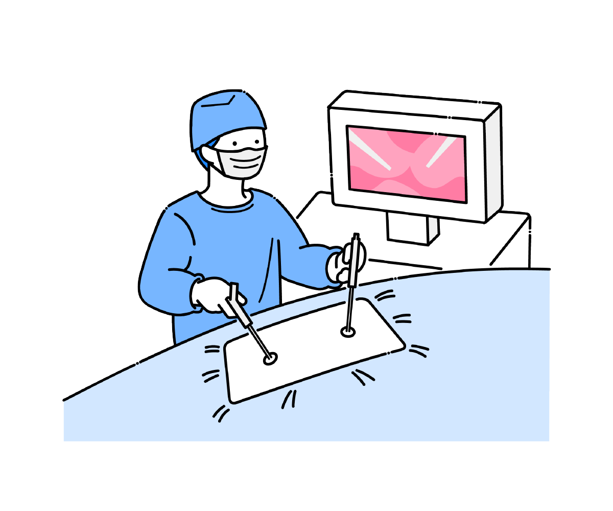 腹腔鏡手術（投影）のイラスト