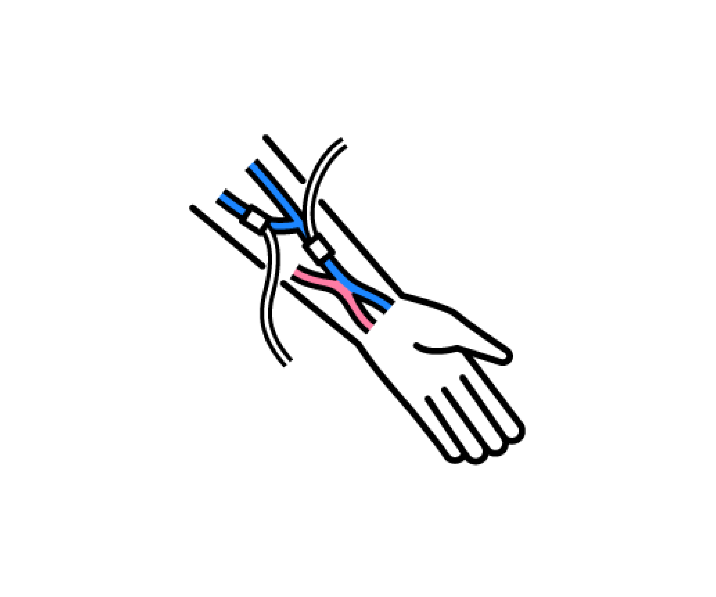 シャントのイラスト